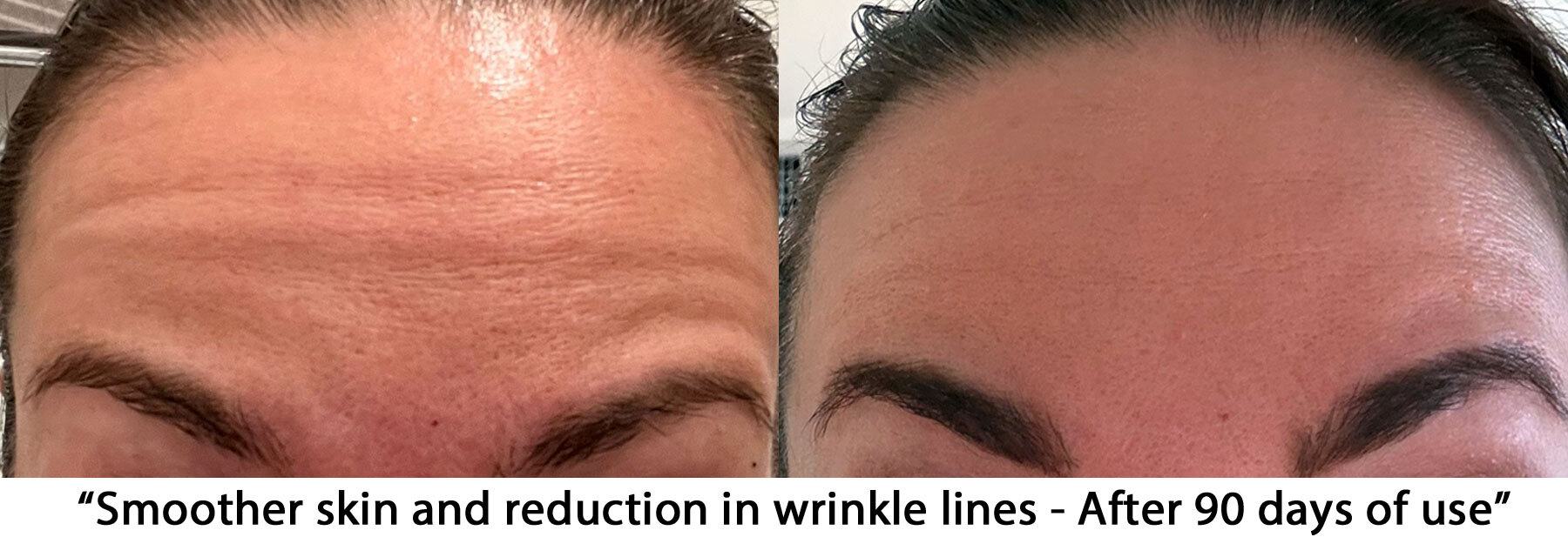 Cacao Bella™ Before After 4