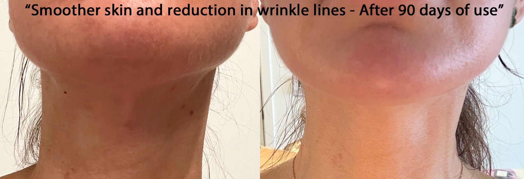 Cacao Bella™ Before After 1