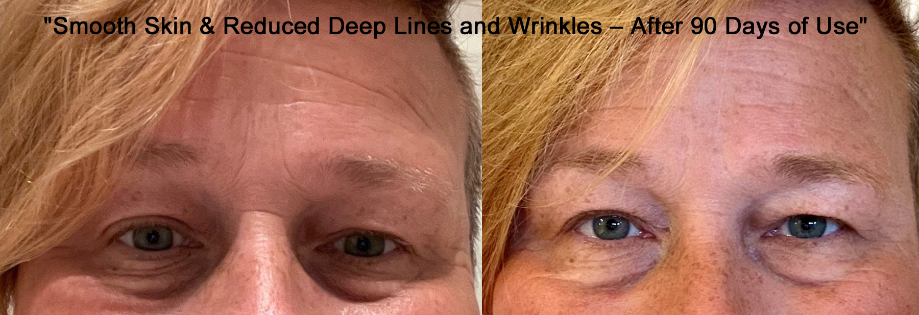 Cacao Bella™ Before After 3