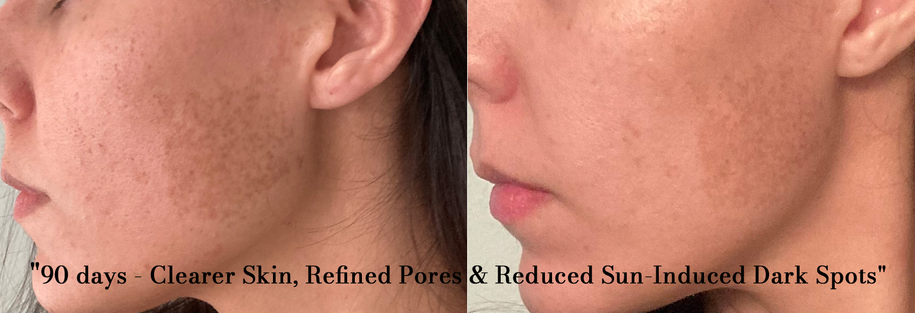 Cacao Bella™ Before After 2